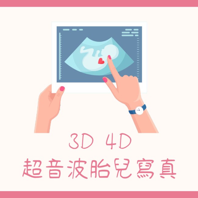 3D 4D超音波胎兒寫真