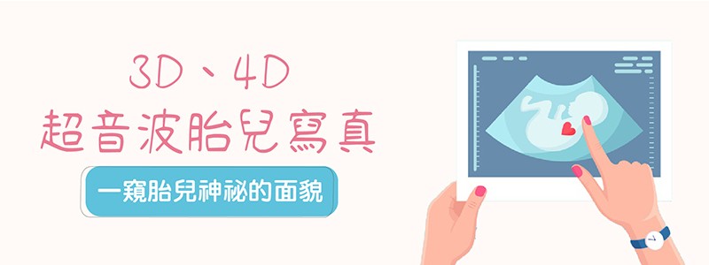 3D 4D超音波胎兒寫真